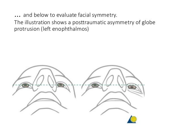 evaluate facial trauma Best sex club